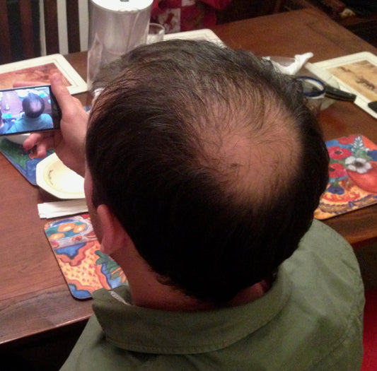 Bald, Bold or Borrowed: Hair Loss, Style & Reinvention Over 50