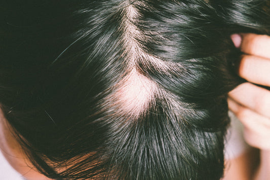 From Thinning to Thriving: Modern Approaches to Hair Loss